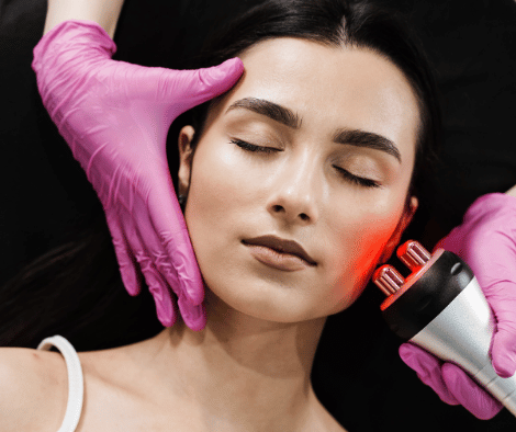 Radiofrecuencia Facial